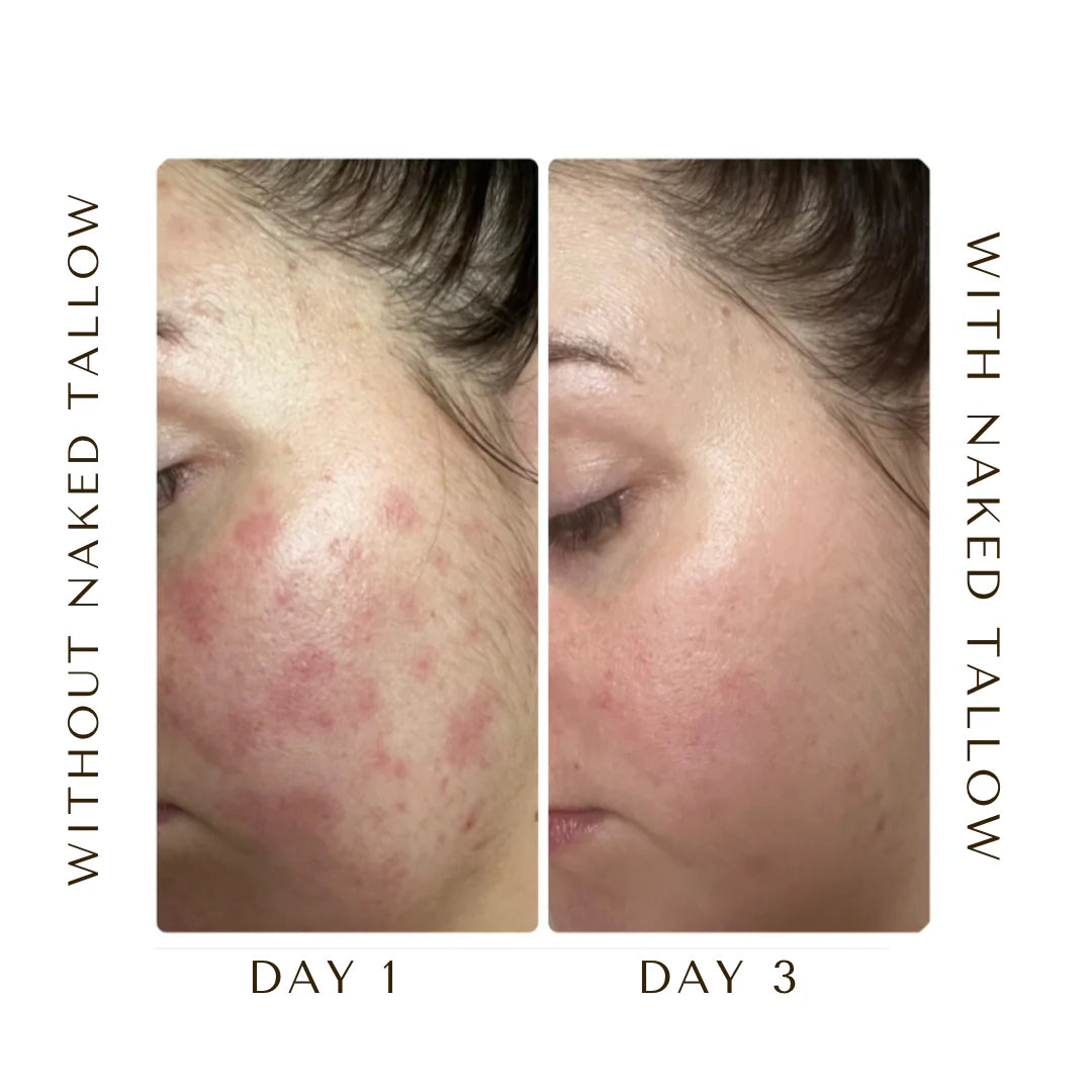 Naked Tallow Sleepytime Grass-Fed Beef Tallow Cream 80g Or 180g, With A Calming Blend Of Essential Oils For All Skin Types