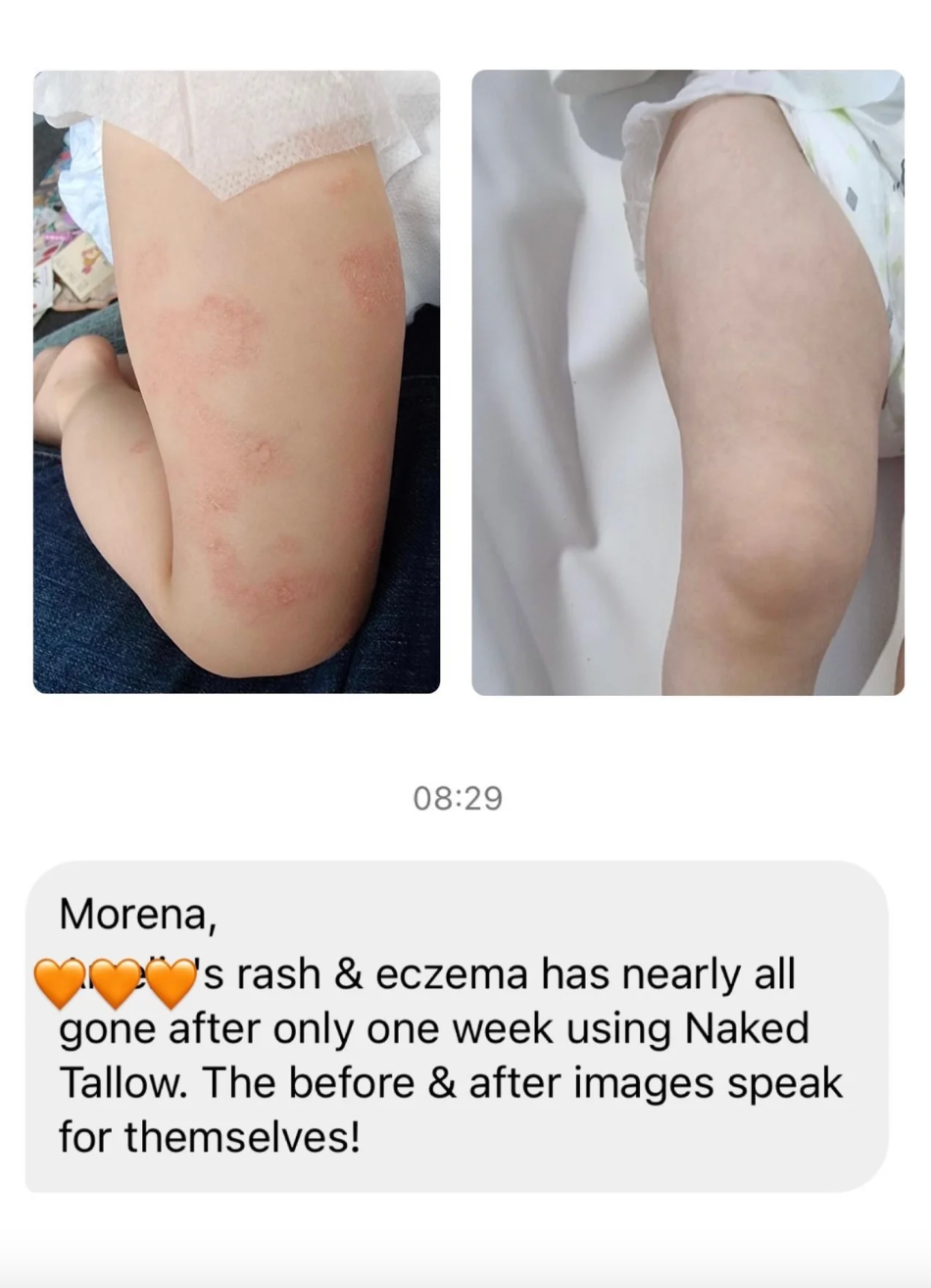 Naked Tallow Calendula Healing Balm 50mL, Soothes Inflamed & Irritated Skin