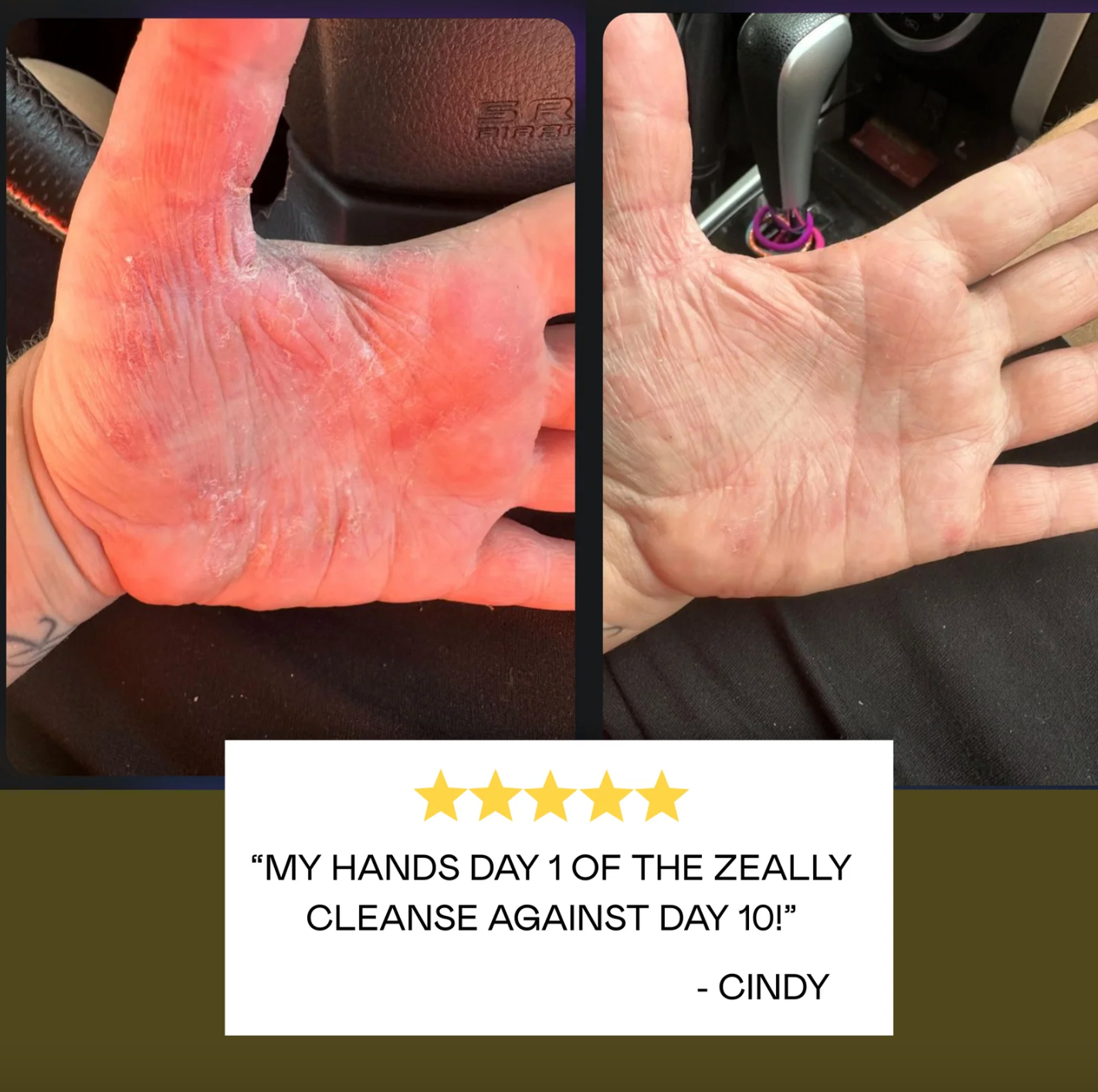 Zeally Herbs 10 Day Para Protocol 60 Capsules, Cleanses & Eliminates Parasites