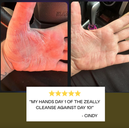 Zeally Herbs 10 Day Para Protocol 60 Capsules, Cleanses & Eliminates Parasites