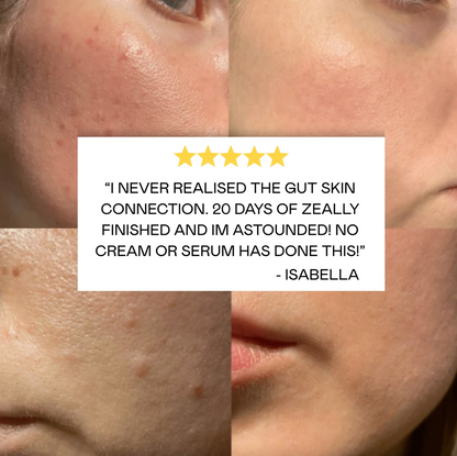 Zeally Herbs 10 Day Para Protocol 60 Capsules, Cleanses & Eliminates Parasites