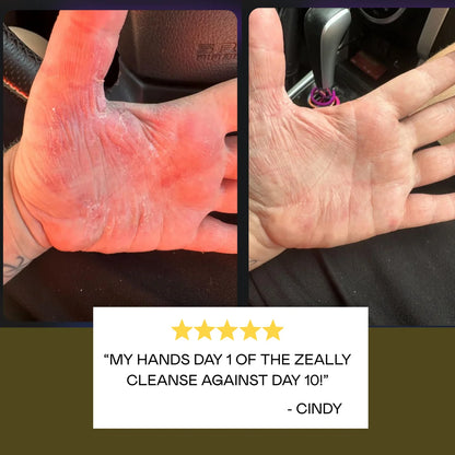 Zeally Herbs 10 Day Cleanse Bundle | Para Protocol & Heavy Metals