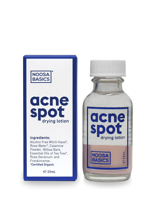 Noosa Basics Acne Spot Drying Lotion 25ml, Alcohol Free